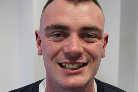 Before and After Invisalign Treatment Wokingham Before and After Invisalign Treatment Wokingham