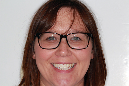 Before and After Invisalign Treatment Wokingham Before and After Invisalign Treatment Wokingham