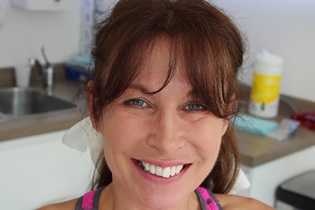 Before and After Invisalign Treatment Wokingham Before and After Invisalign Treatment Wokingham
