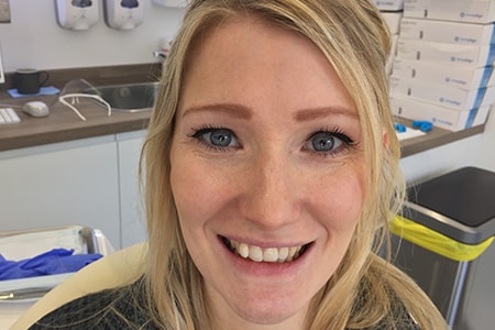 Before and After Invisalign Treatment Kingston Before and After Invisalign Treatment Kingston