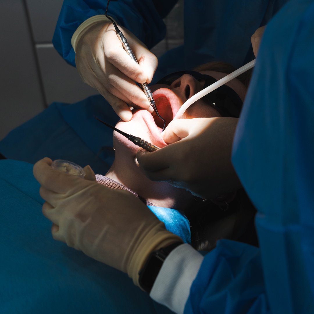 Same-Day-Tooth-Implants-Reading