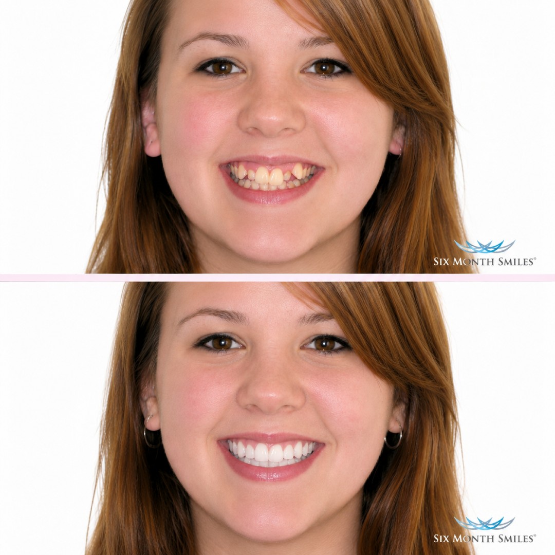 before-after-9