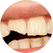Damaged tooth