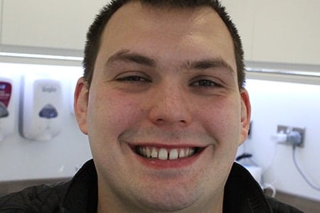 Before Invisalign Treatment Reading Smiles 