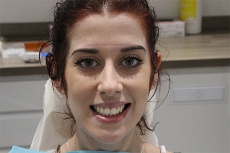 Before Smile Makeover Treatment Smile Rooms 